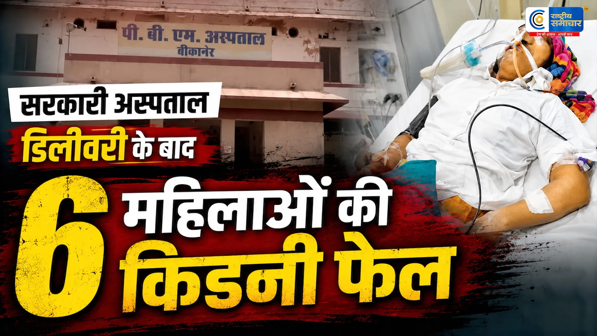बीकानेर के पीबीएम अस्पताल में बड़ा स्वास्थ्य संकटसीजेरियन डिलीवरी के बाद 6 महिलाओं की किडनी फेल