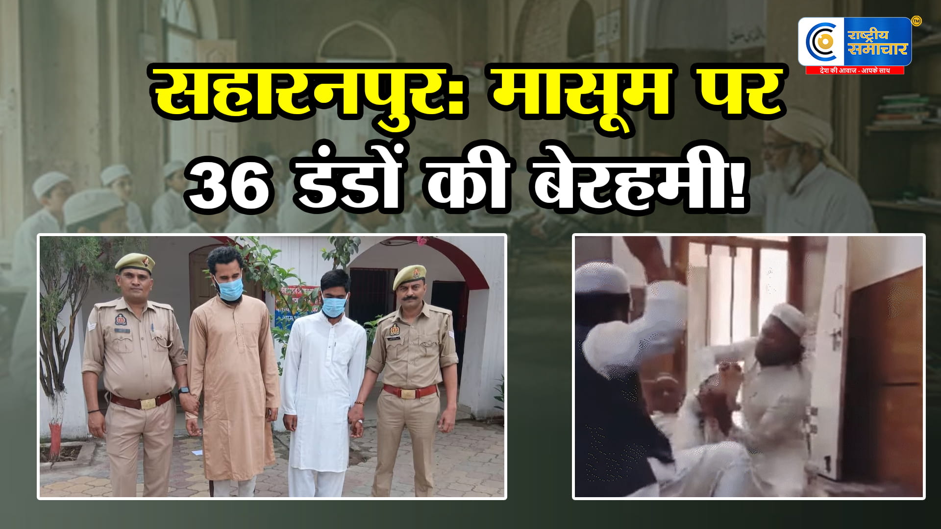 सहारनपुर मदरसा हिंसा:10 वर्षीय मासूम बच्चे पर मौलानाओं द्वारा बेरहमी से पिटाई, मासूम बच्चे पर 36 डंडों की बेरहमी, पुलिस ने लिया एक्शन