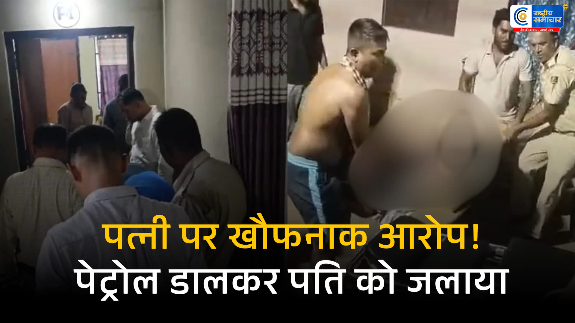 ओडिशा में पुलिस कांस्टेबलको जिंदा जलाने की कोशिश का आरोप, पत्नी और साले पर पेट्रोल डालकर आग लगाने का दावा